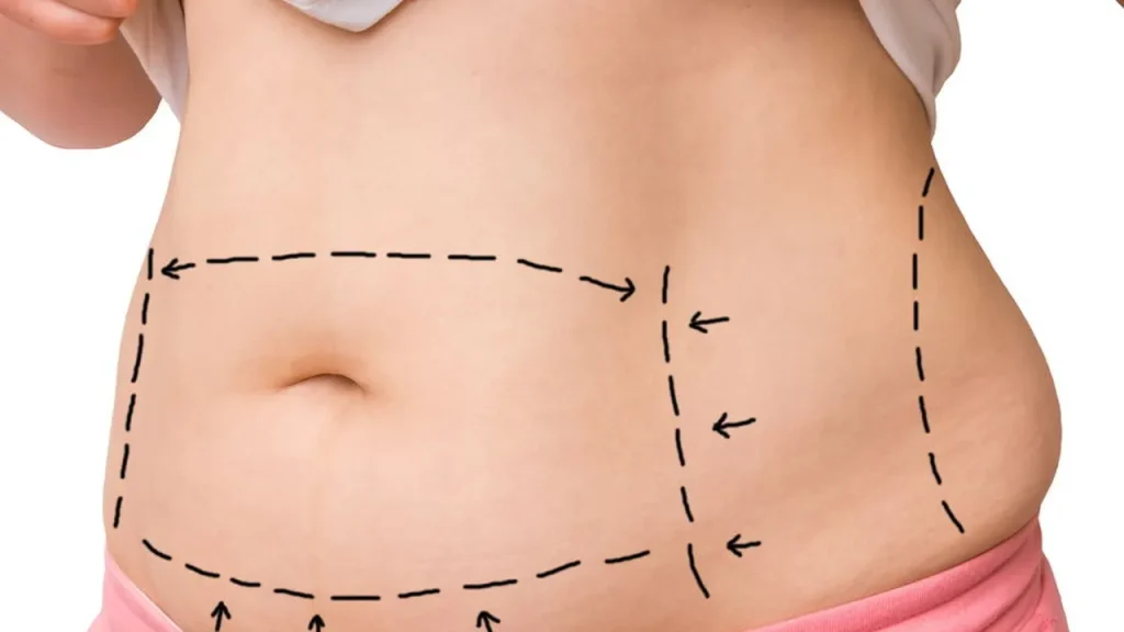 Avanço na tecnologia leva cirurgias plásticas a um novo nível de segurança avan o na tecnologia leva cirurgias pl sticas a um novo n vel de seguran a 218ed5e5